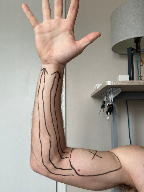 myofascial release forearm elbow wrist