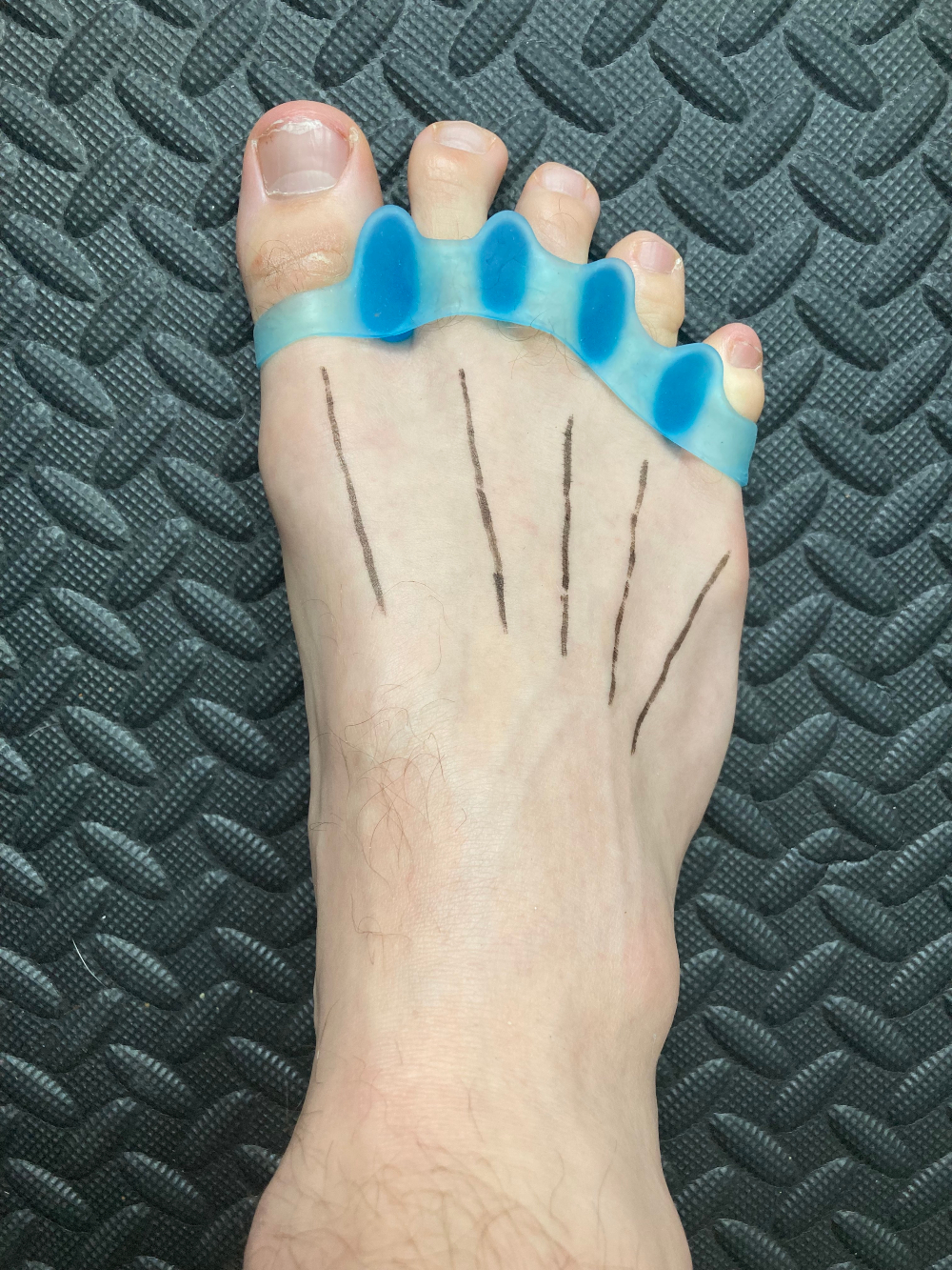 toes natural alignment
