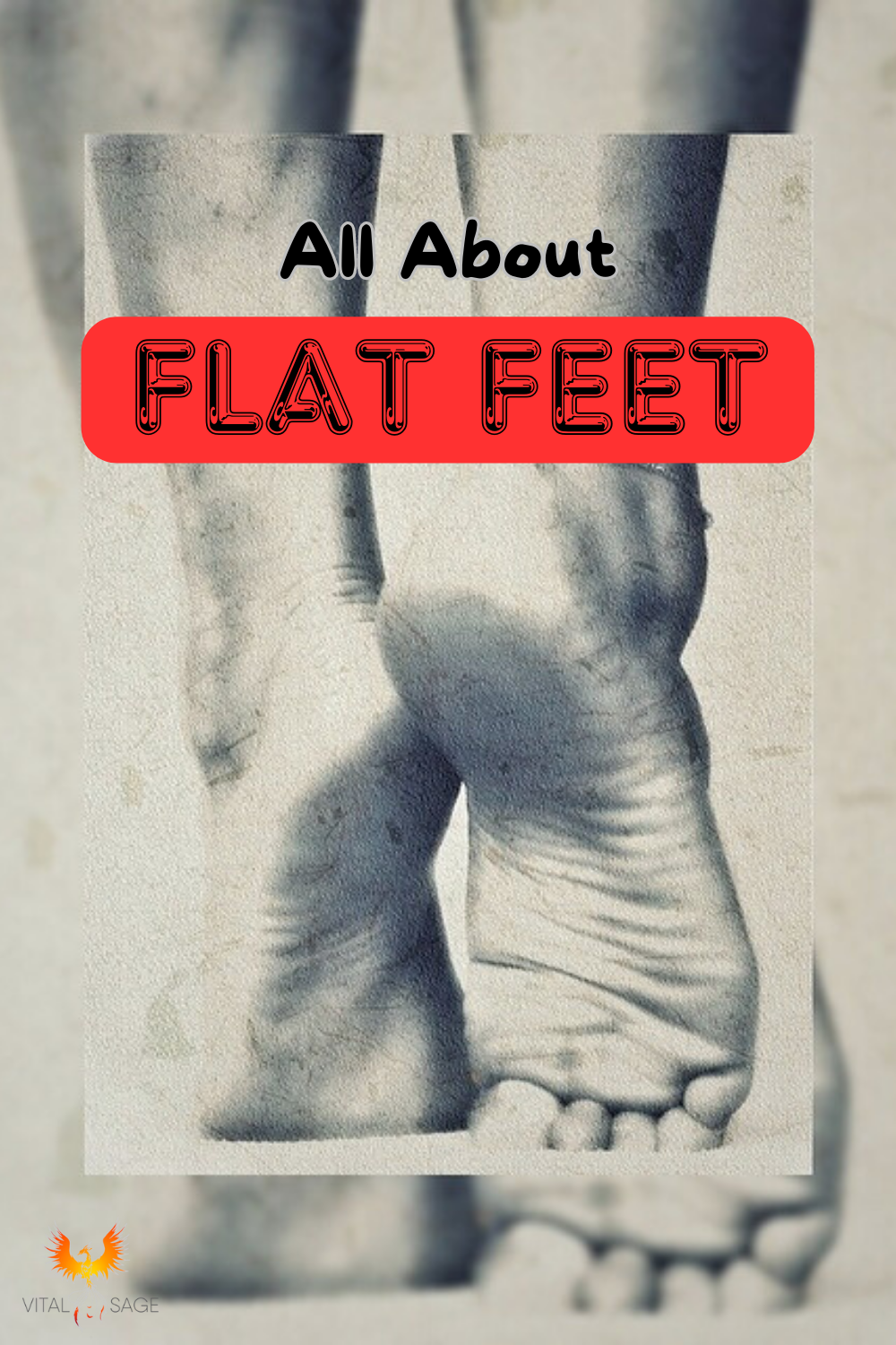 Flat Feet – The Real Cause, Problems It Leads to, How to Fix It